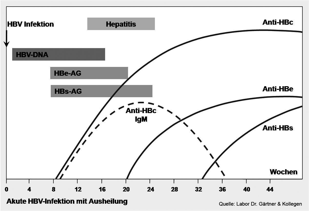 Akute_HBV-Infektion_mit_Ausheilung.jpg